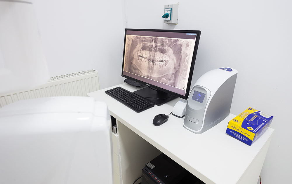 Radiologie Dentara 3D Radauti, Scano Dent (20)